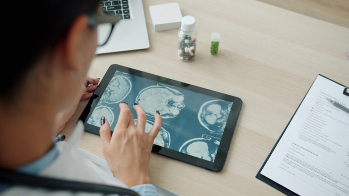 Doctor examining mri scans on a tablet screen medical imaging, scan comparison, healthcare artificial intelligence